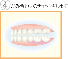 かみ合せのチェックをします